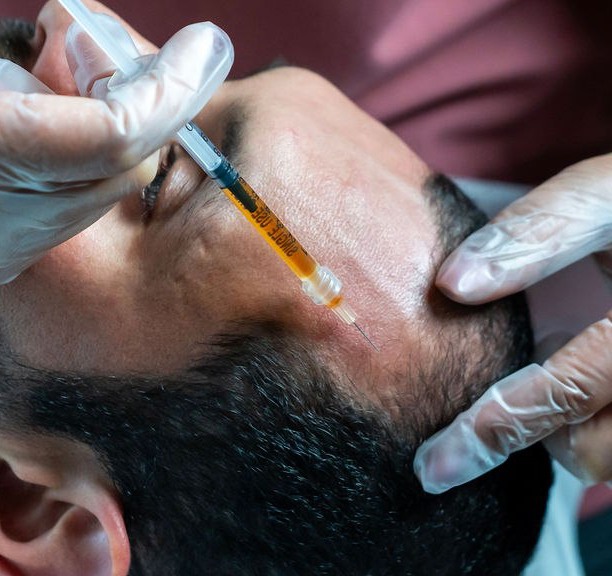 PRP Platelet-Rich Plasma Therapy